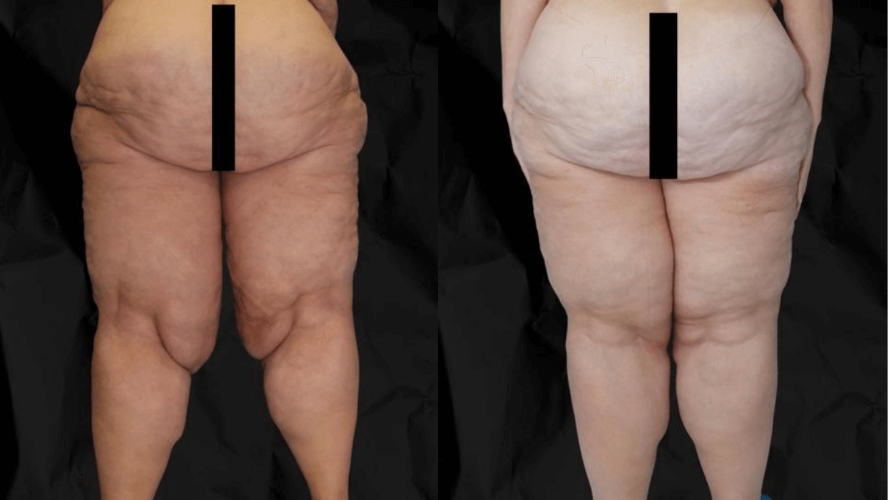 weight 2